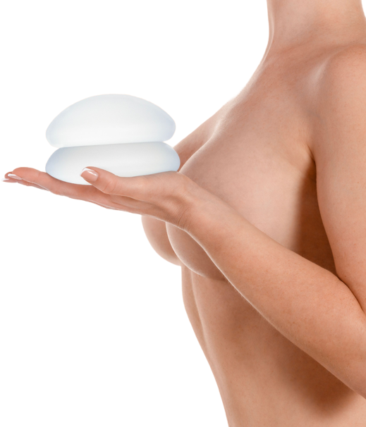 Увеличение груди (аугментационная маммопластика) Увеличение груди (аугментационная маммопластика) – Маммопластика (пластика груди), фото